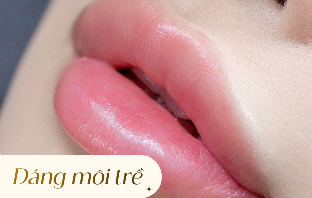 Dáng môi trề và mẹo khắc phục tại nhà