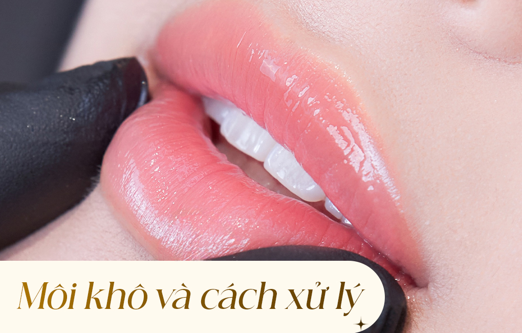 Nguyên nhân khiến môi khô và cách phòng ngừa, khắc phục