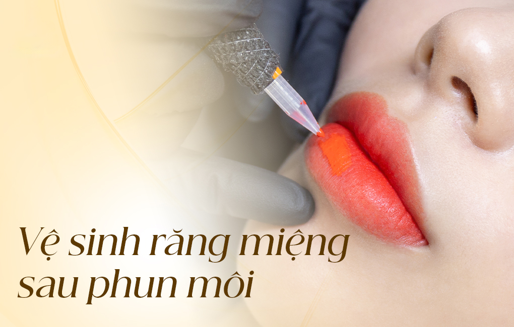 Điều mà bạn chưa biết về vệ sinh răng miệng sau khi phun môi