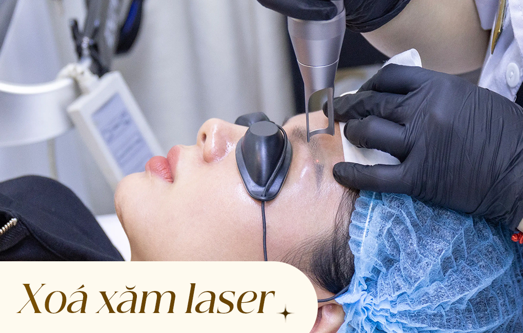 Xoá xăm laser và những điều cần biết