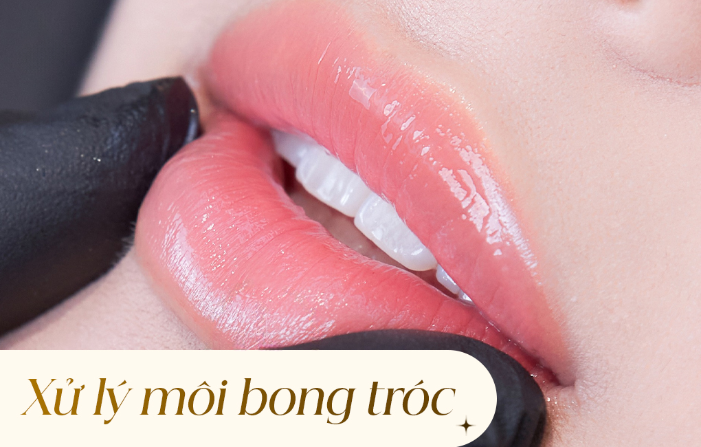 Nguyên nhân và cách trị môi bong tại nhà