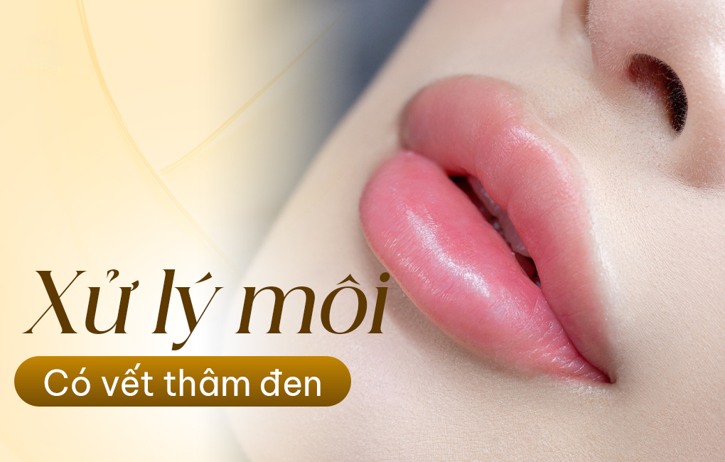 Nguyên nhân dẫn đến môi có vết thâm đen và các phương pháp khắc phục